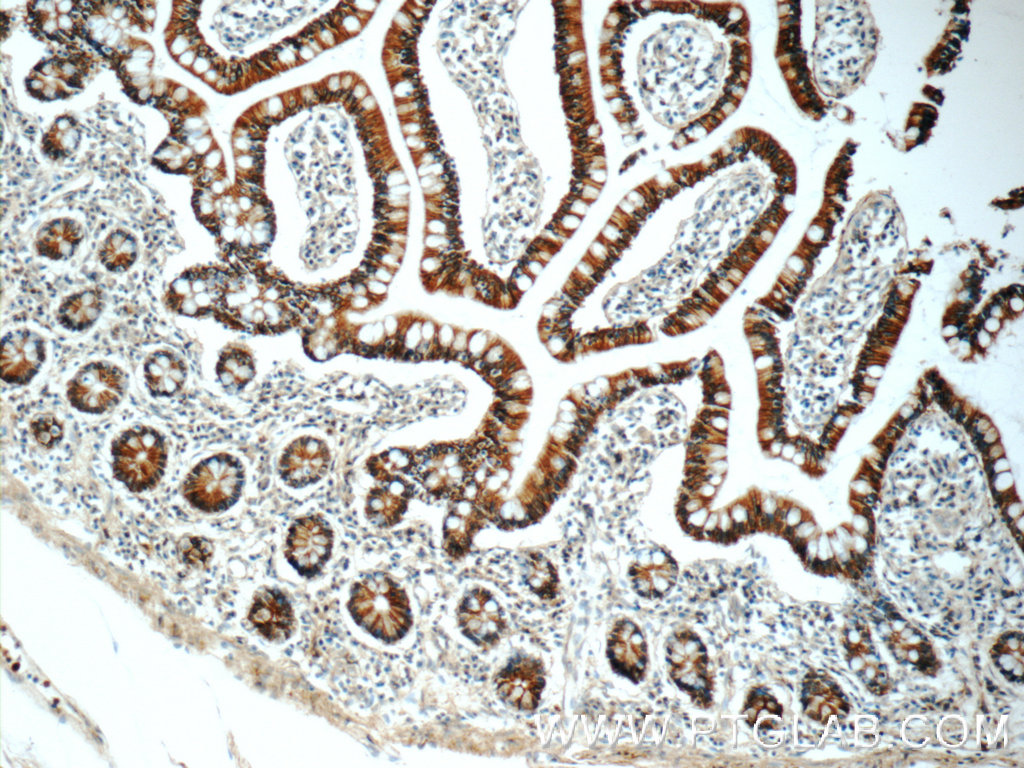 IHC staining of human small intestine using 19505-1-AP