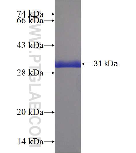 NPHP1 fusion protein Ag22965 SDS-PAGE NPHP1 fusion protein Ag22965 SDS-PAGE