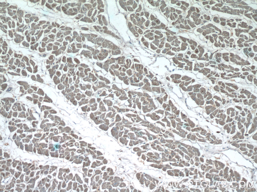 IHC staining of human heart using 22026-1-AP