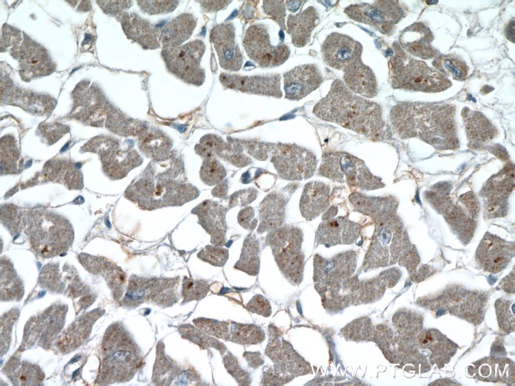 IHC staining of human heart using 22026-1-AP