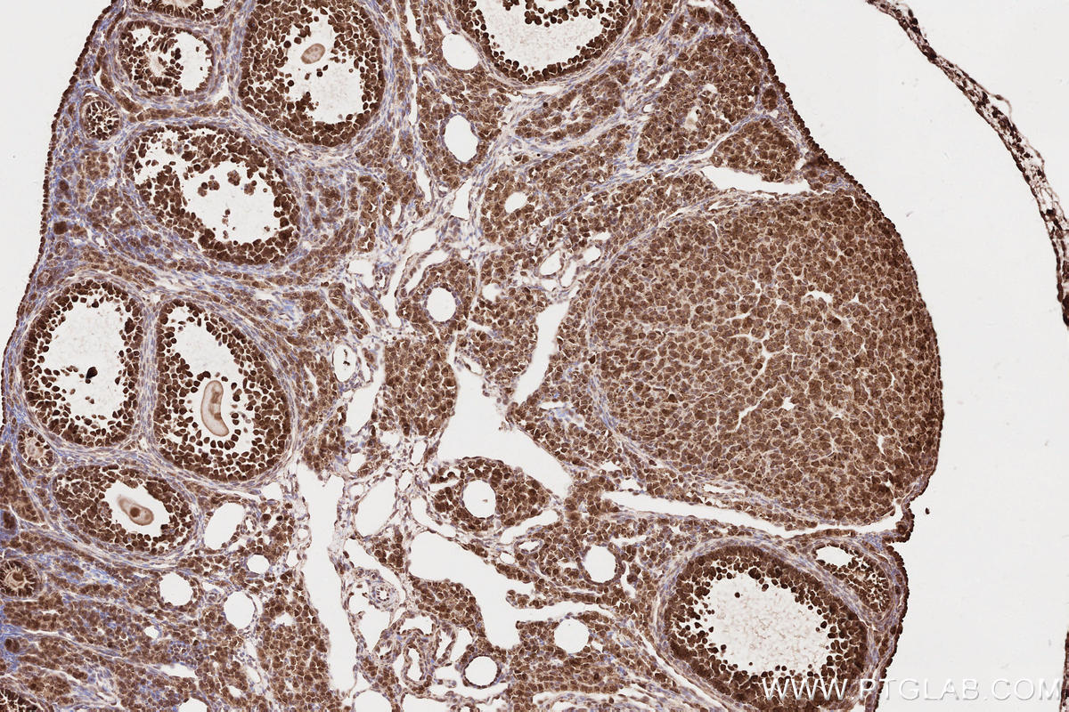IHC staining of mouse ovary using 22026-1-AP IHC staining of mouse ovary using 22026-1-AP