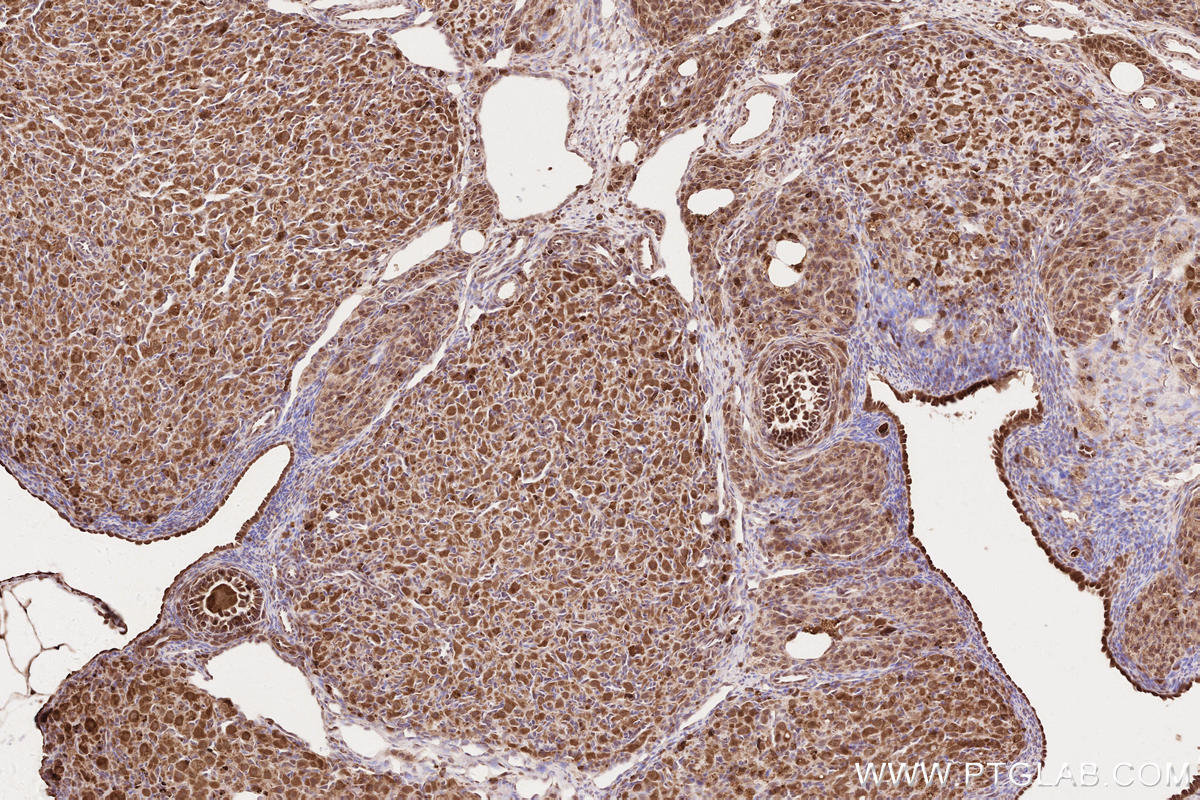 IHC staining of rat ovary using 22026-1-AP IHC staining of rat ovary using 22026-1-AP