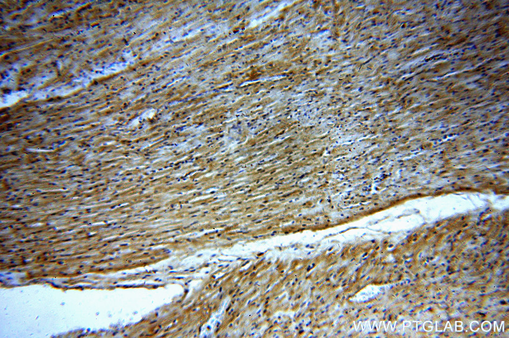 IHC staining of human heart using 13812-1-AP