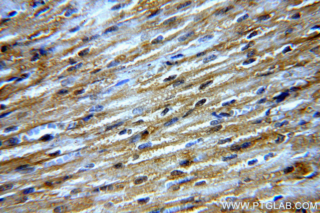IHC staining of human heart using 13812-1-AP