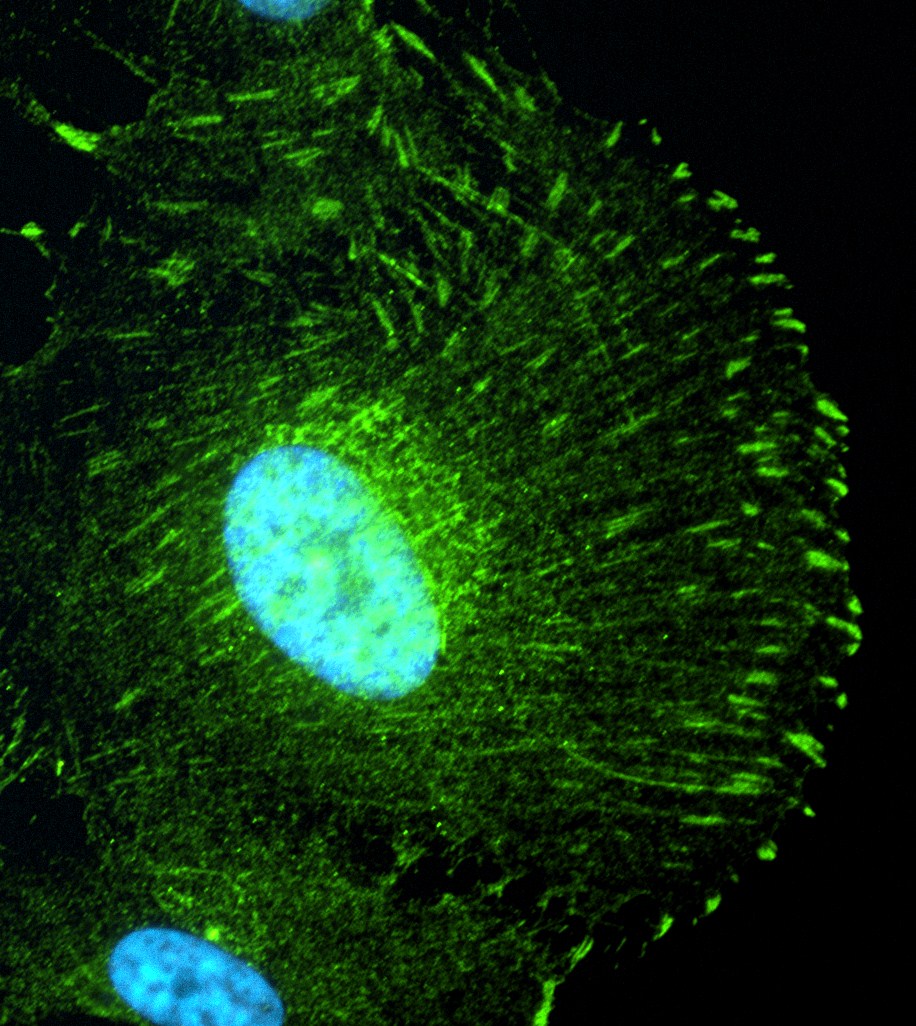 NPHP5/IQCB1 Polyclonal antibody