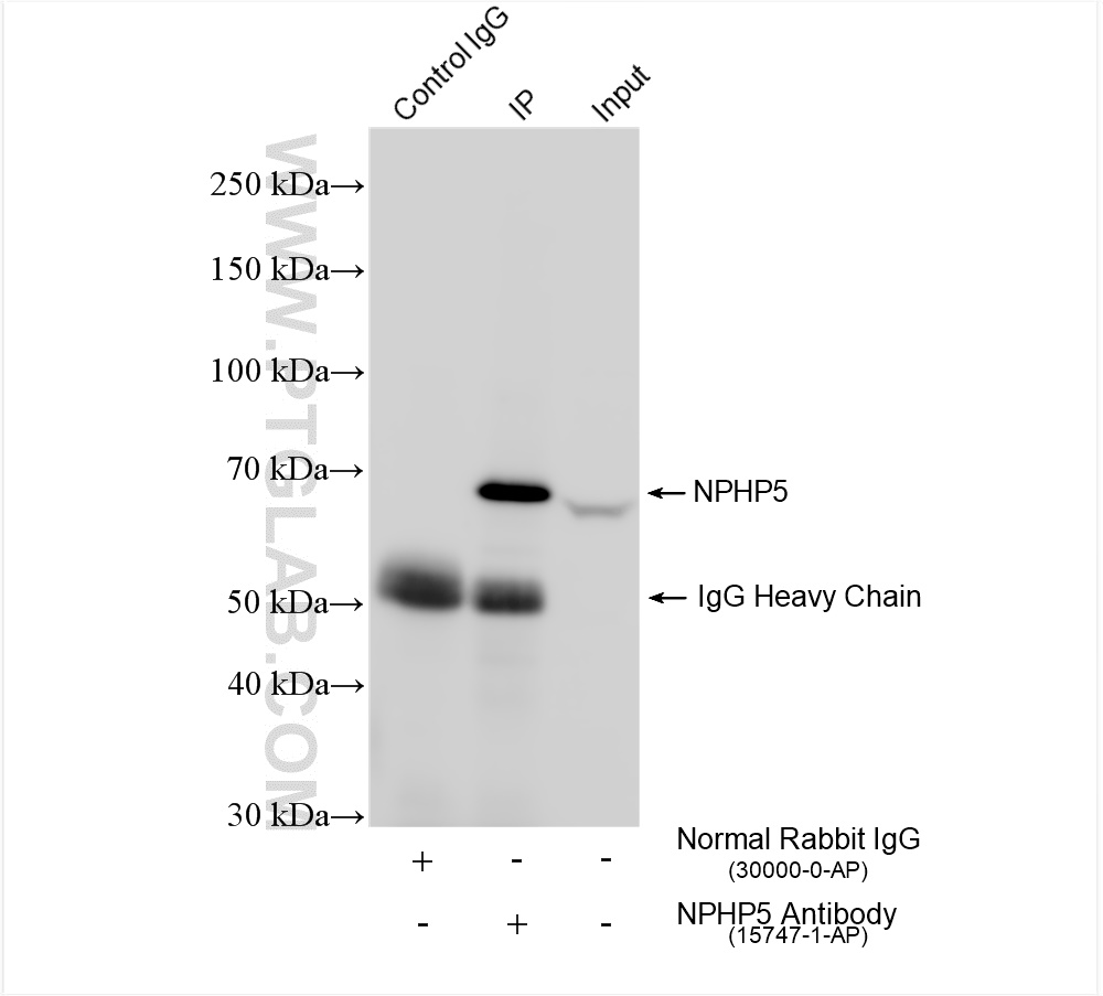 IP experiment of HEK-293 using 15747-1-AP