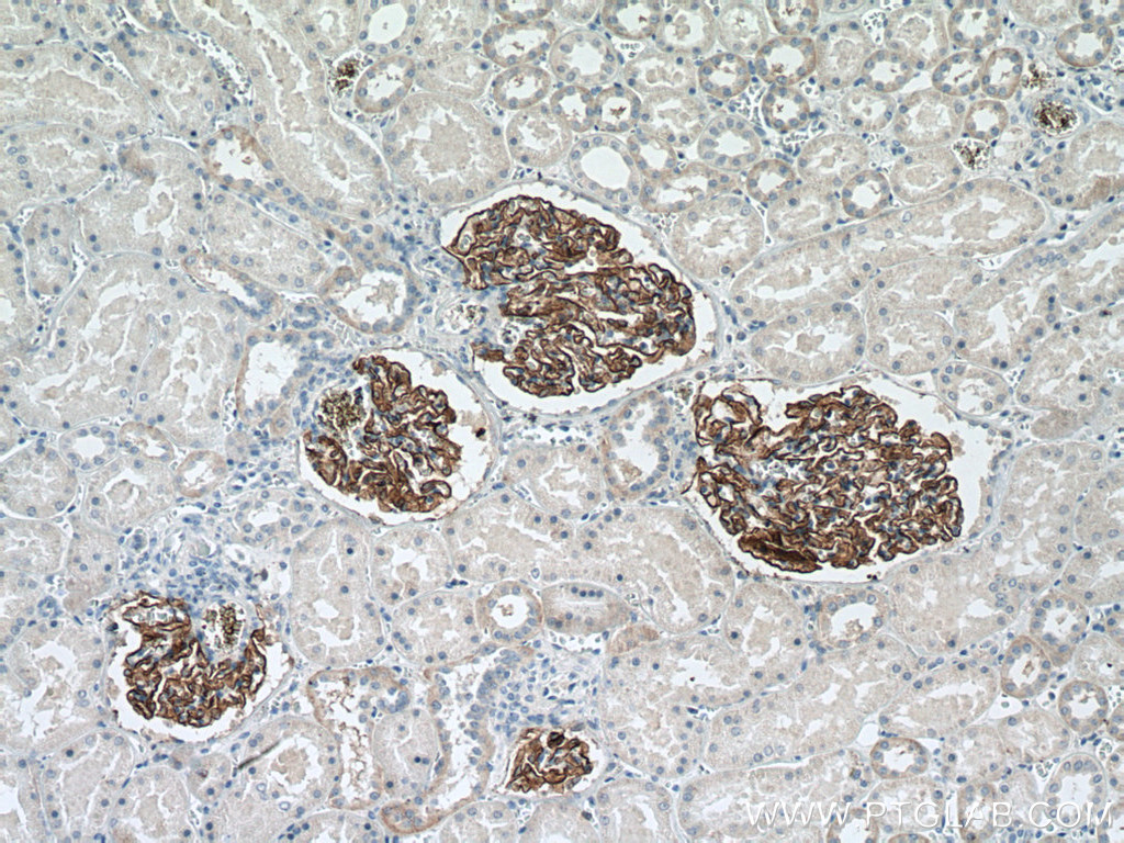 IHC staining of human kidney using 66970-1-Ig (same clone as 66970-1-PBS)