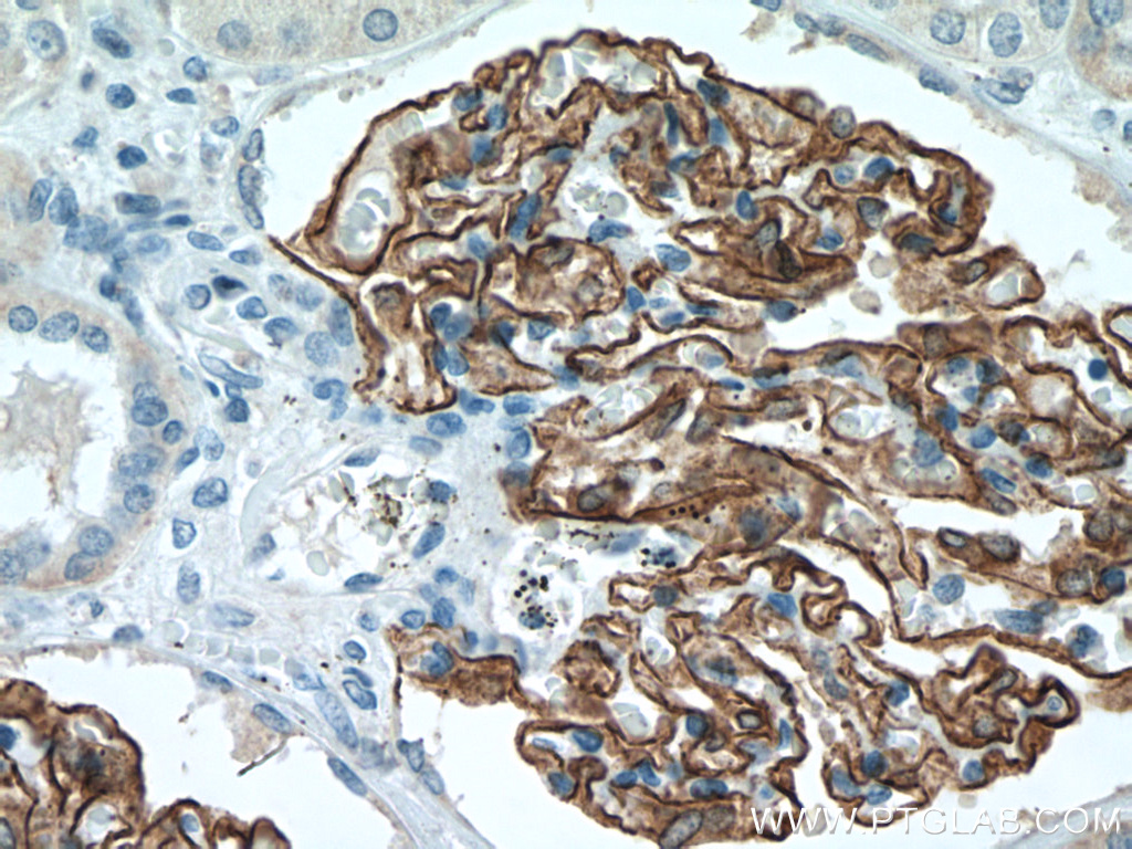 IHC staining of human kidney using 66970-1-Ig (same clone as 66970-1-PBS)