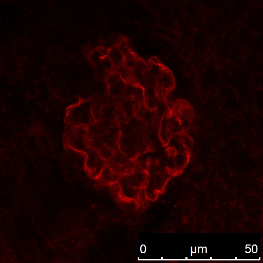 NPHS2 Polyclonal antibody