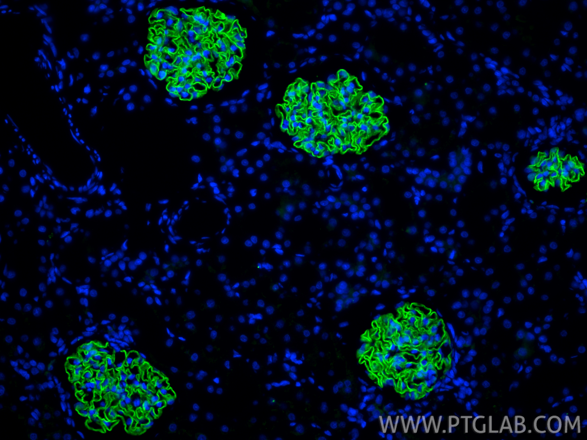 Immunofluorescent analysis of (4% PFA) fixed paraffin-embedded rat kidney tissue using NPHS2 antibody (20384-1-AP) at dilution of 1:1000 and CoraLite®488-Conjugated Goat Anti-Rabbit IgG(H+L) (<a class='green' href='/productredirect?CatalogNo=SA00013-2' target='_blank'>SA00013-2</a>). Heat mediated antigen retrieval with Tris-EDTA buffer (pH 9.0). IF Staining of rat kidney using 20384-1-AP