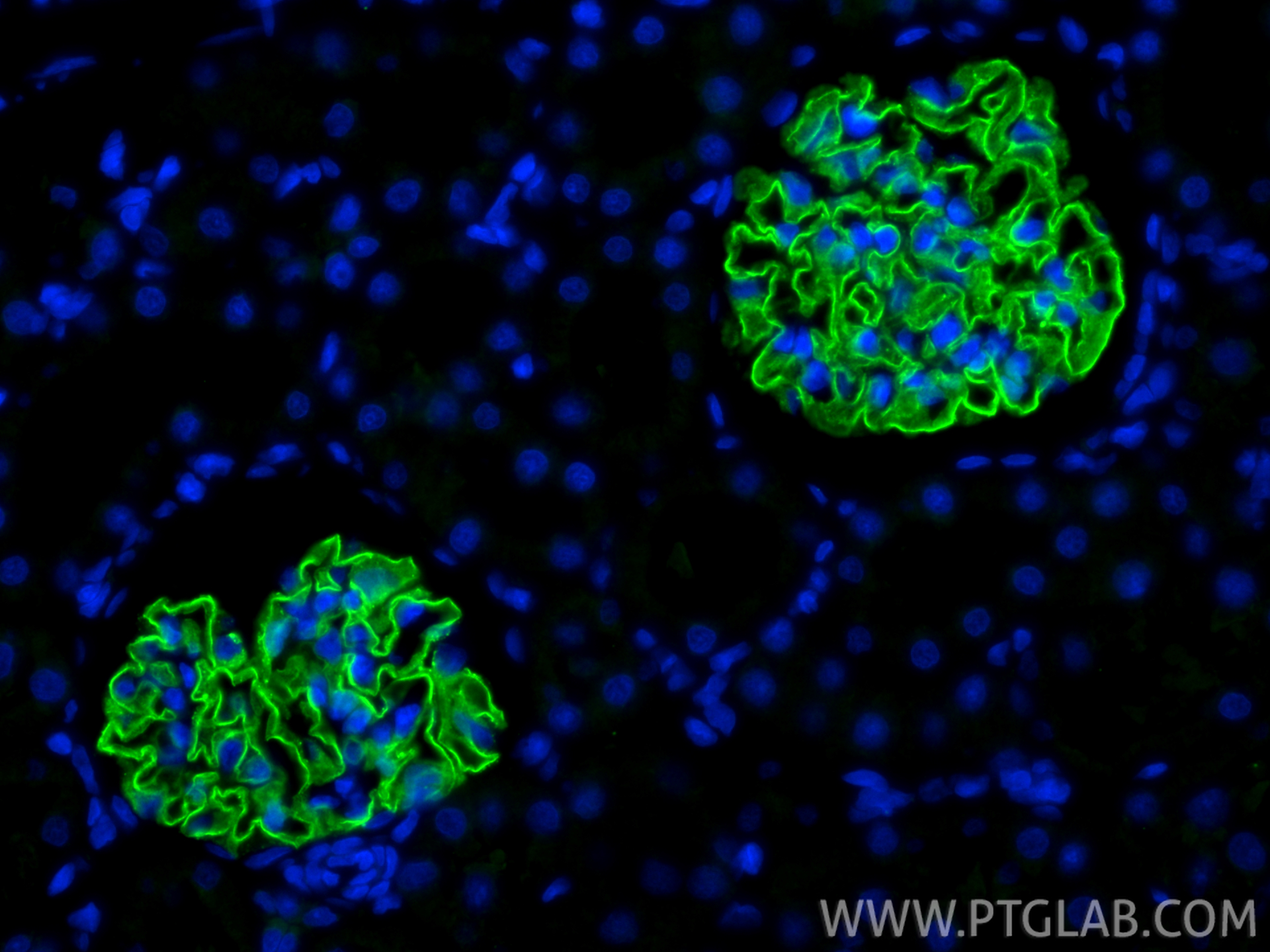 Immunofluorescent analysis of (4% PFA) fixed paraffin-embedded rat kidney tissue using NPHS2 antibody (20384-1-AP) at dilution of 1:1000 and CoraLite®488-Conjugated Goat Anti-Rabbit IgG(H+L) (<a class='green' href='/productredirect?CatalogNo=SA00013-2' target='_blank'>SA00013-2</a>). Heat mediated antigen retrieval with Tris-EDTA buffer (pH 9.0). IF Staining of rat kidney using 20384-1-AP