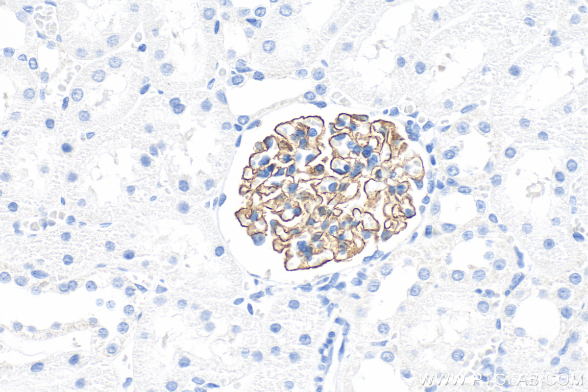 Immunohistochemical analysis of paraffin-embedded rat kidney tissue slide using 20384-1-AP (NPHS2 antibody) at dilution of 1:2000 (under 40x lens). Heat mediated antigen retrieval with Tris-EDTA buffer (pH 9.0). IHC staining of rat kidney using 20384-1-AP