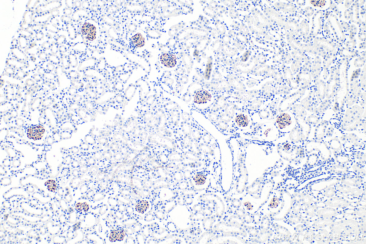 IHC staining of mouse kidney using 20384-1-AP
