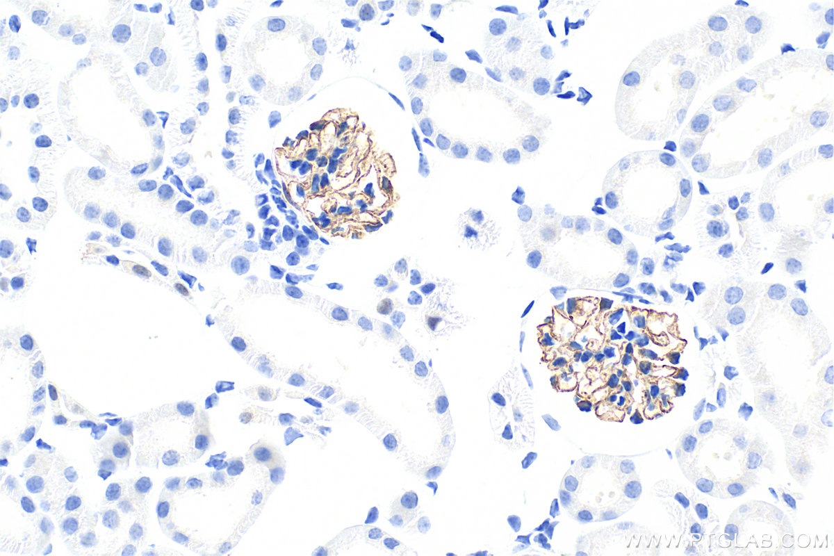 IHC staining of mouse kidney using 20384-1-AP