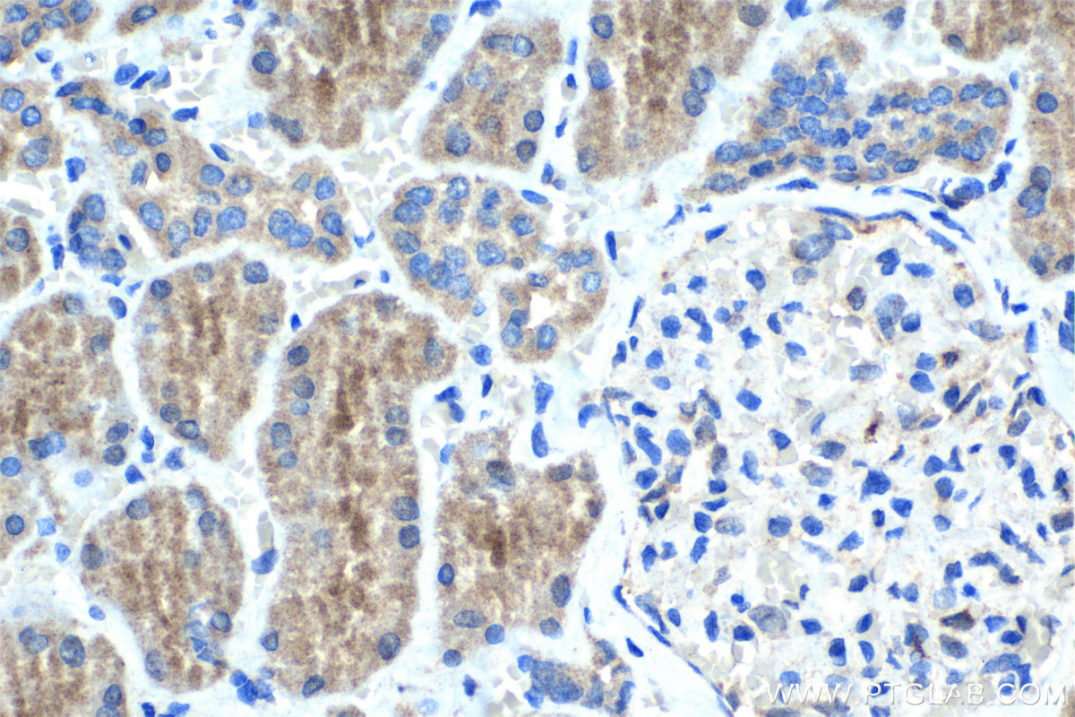 Immunohistochemical analysis of paraffin-embedded human kidney tissue slide using 11638-1-AP (NPLOC4 antibody) at dilution of 1:1000 (under 40x lens). Heat mediated antigen retrieval with Tris-EDTA buffer (pH 9.0). IHC staining of human kidney using 11638-1-AP