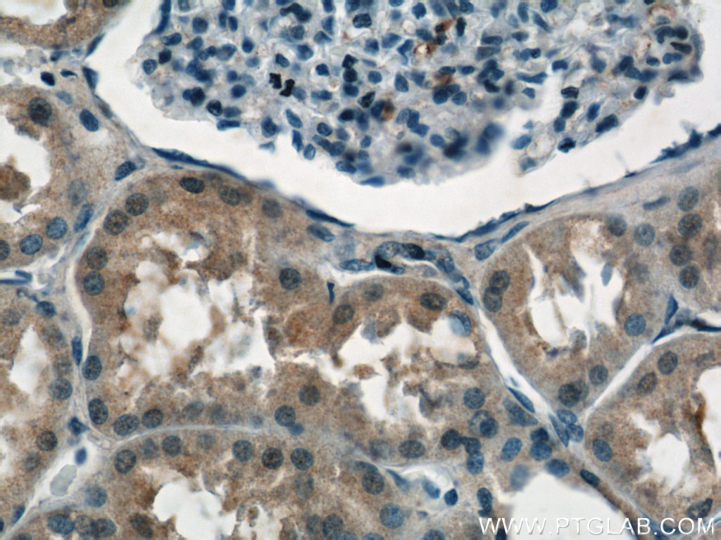 IHC staining of human kidney using 11638-1-AP