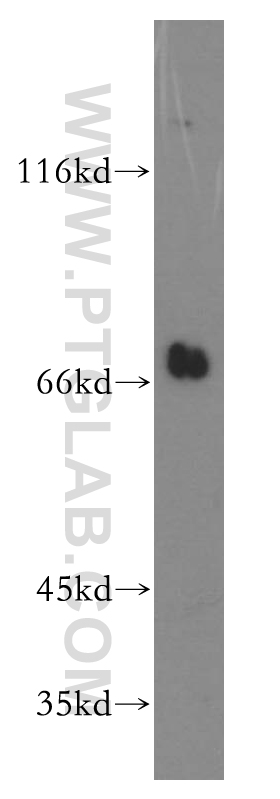 WB analysis of mouse kidney using 11638-1-AP