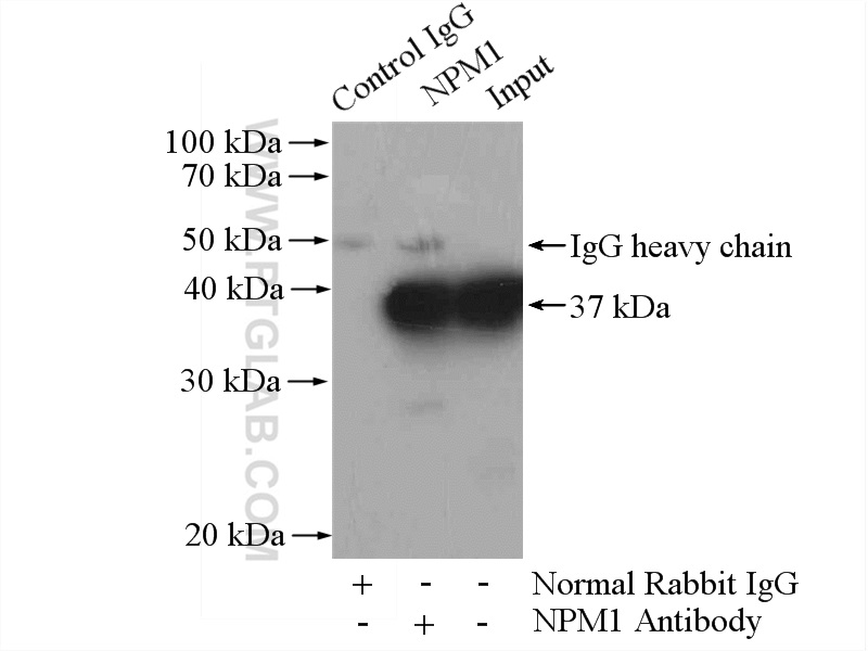 IP experiment of Jurkat using 10306-1-AP