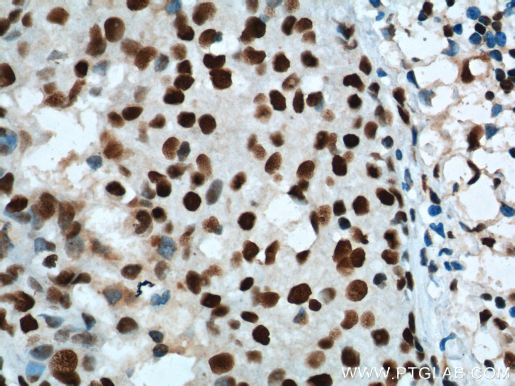 B23/NPM1 Monoclonal antibody