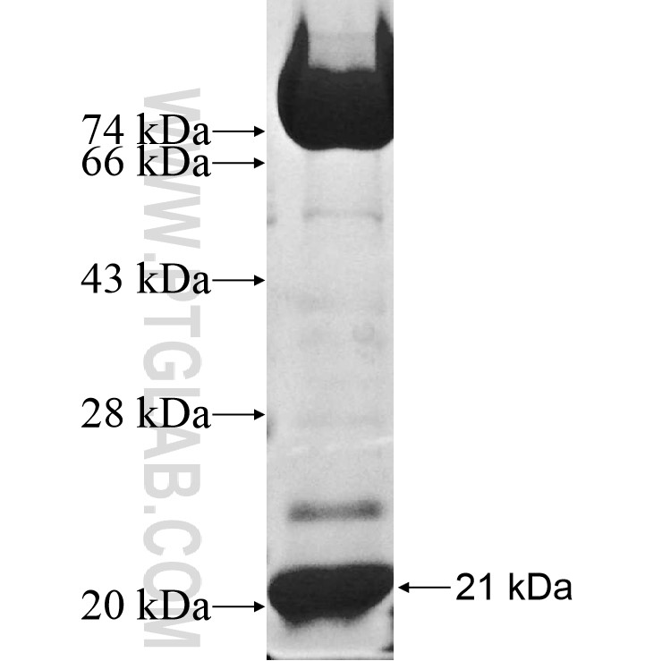 NPM2 fusion protein Ag10365 SDS-PAGE NPM2 fusion protein Ag10365 SDS-PAGE