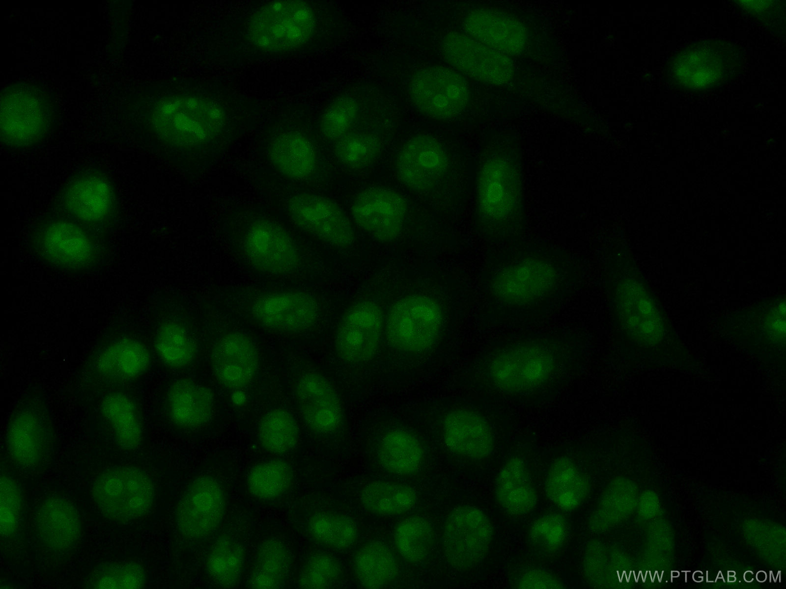 IF Staining of HeLa using 11960-1-AP