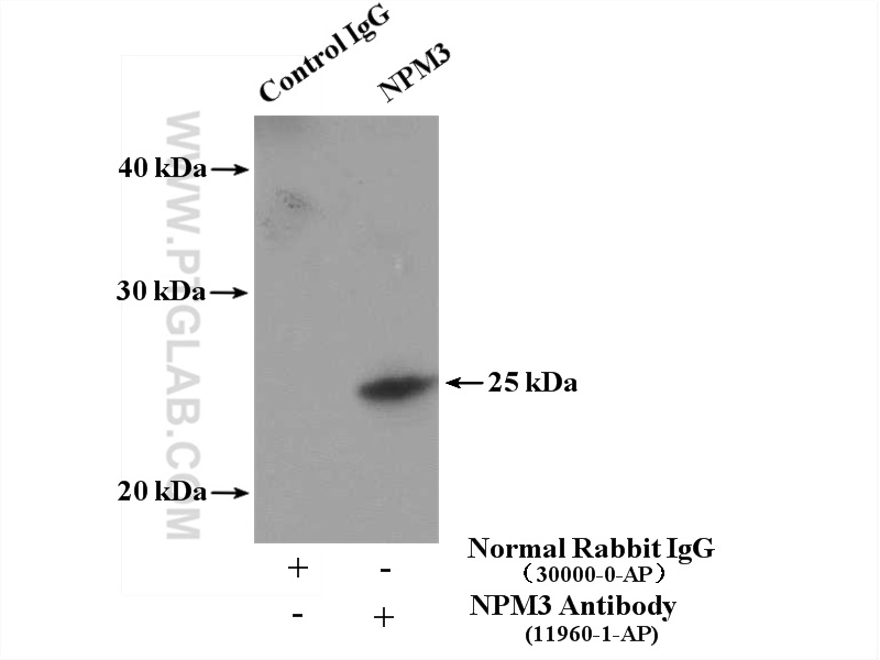 IP experiment of HeLa using 11960-1-AP