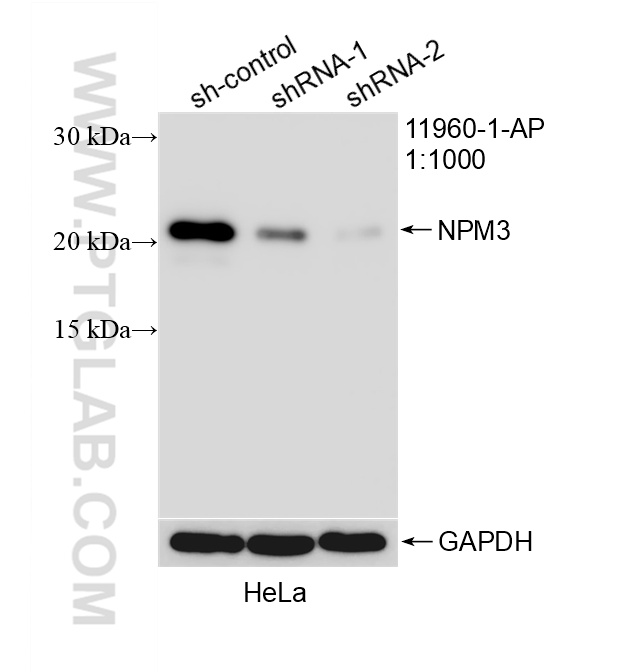 WB analysis of HeLa using 11960-1-AP WB analysis of HeLa using 11960-1-AP