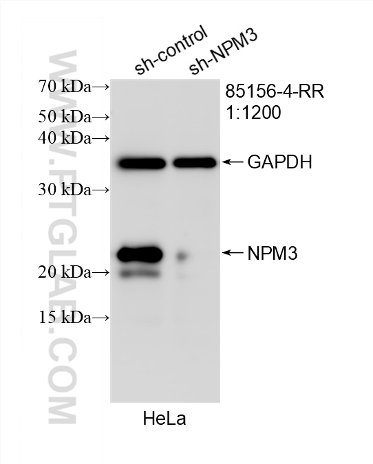 WB analysis of HeLa using 85156-4-RR (same clone as 85156-4-PBS)