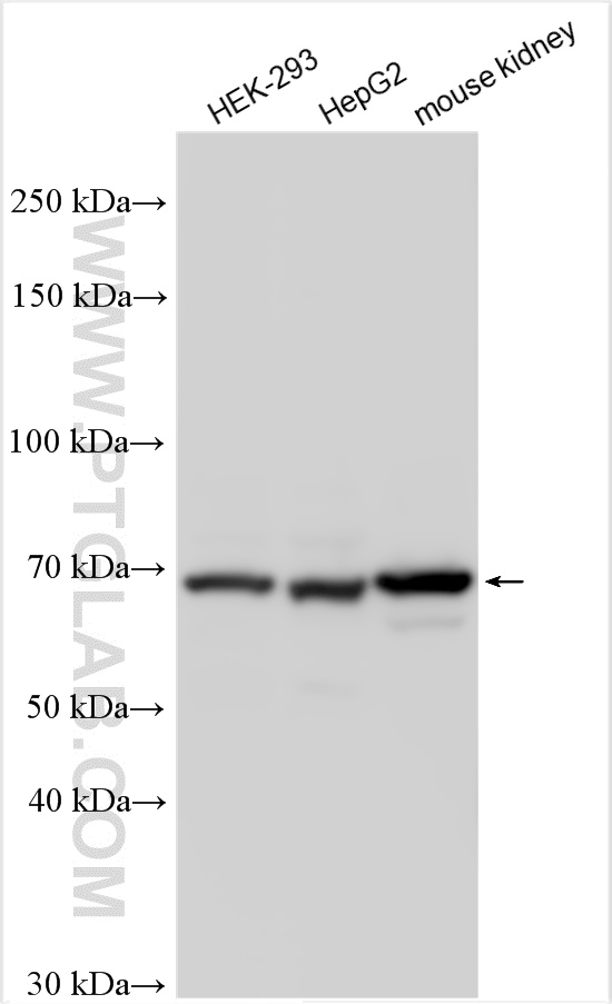 WB analysis using 30836-1-AP