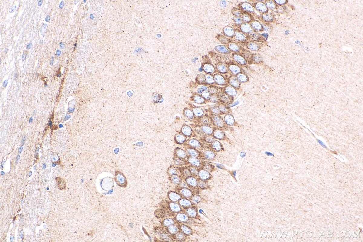 IHC staining of mouse brain using 13299-1-AP