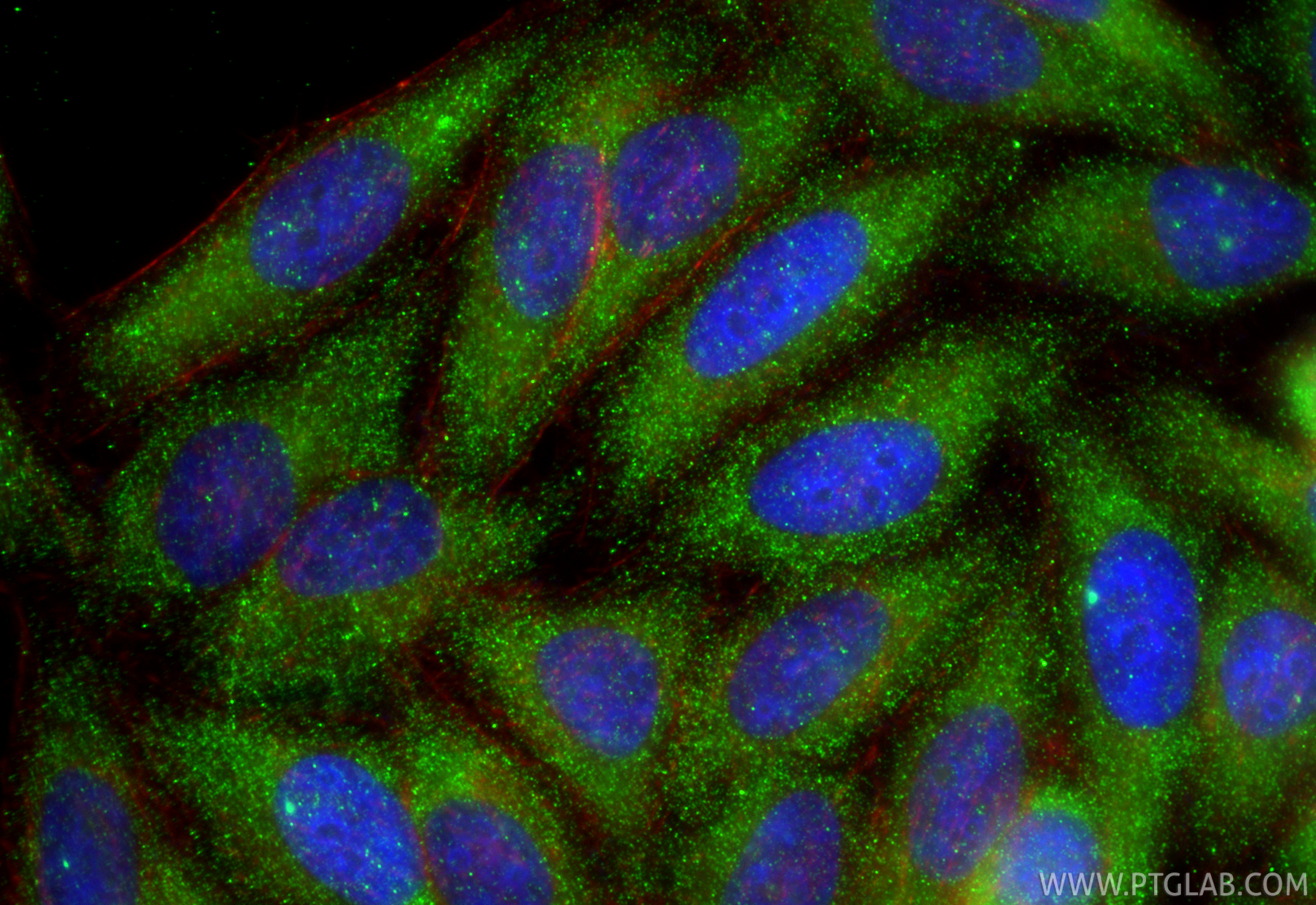 IF Staining of HepG2 using 28214-1-AP IF Staining of HepG2 using 28214-1-AP