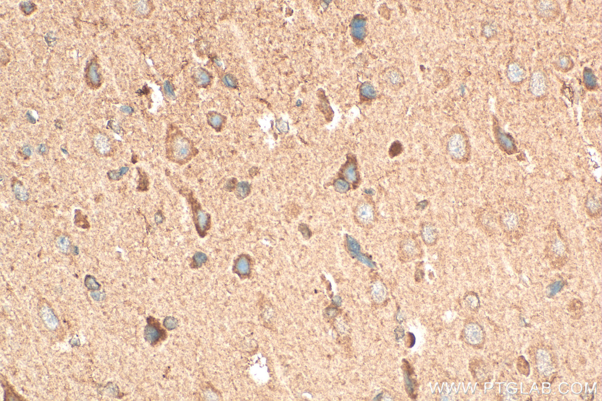 IHC staining of rat brain using 28214-1-AP
