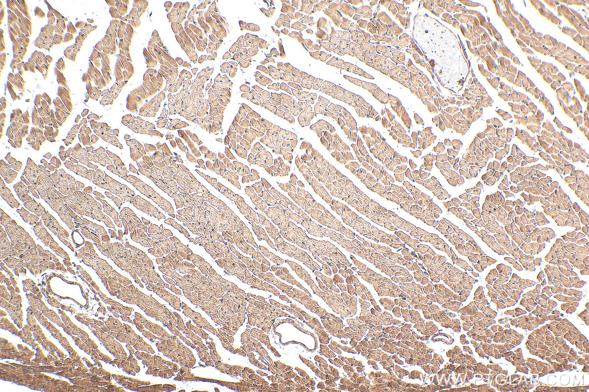 IHC staining of mouse heart using 28214-1-AP