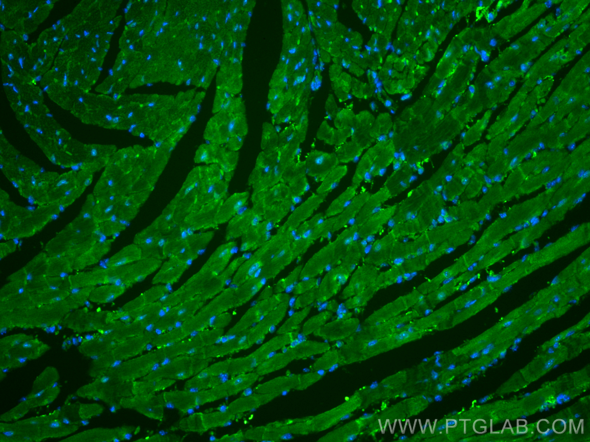 IF Staining of mouse heart using 29352-1-AP