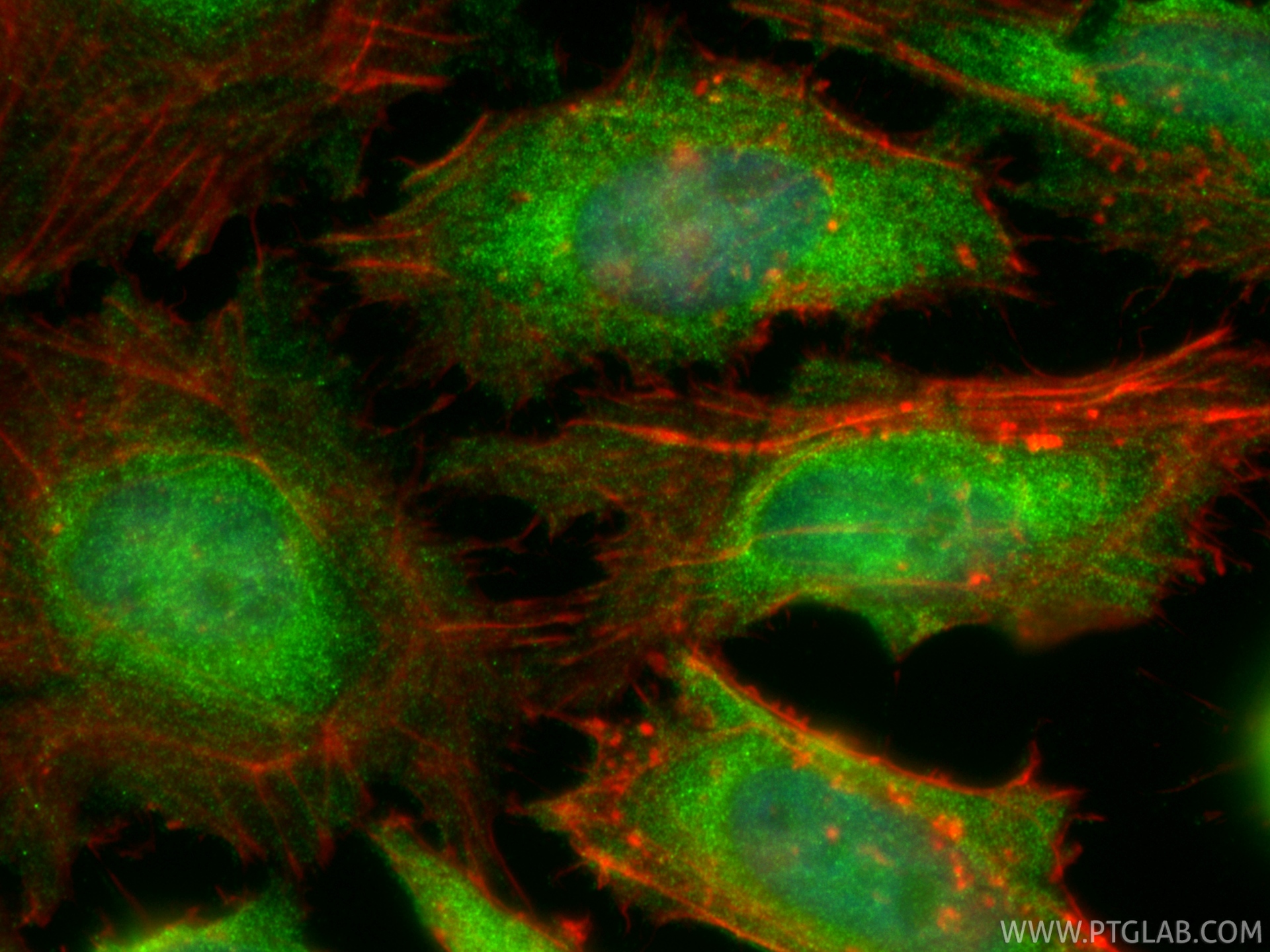 IF Staining of HeLa using 55116-1-AP IF Staining of HeLa using 55116-1-AP