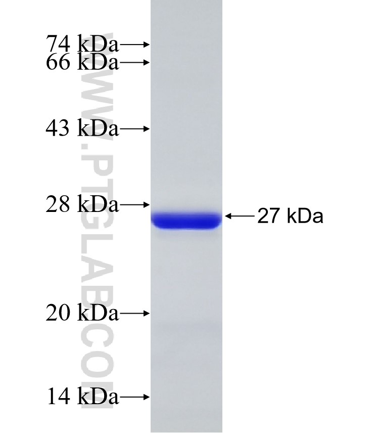 NPR2 fusion protein Ag32751 SDS-PAGE NPR2 fusion protein Ag32751 SDS-PAGE