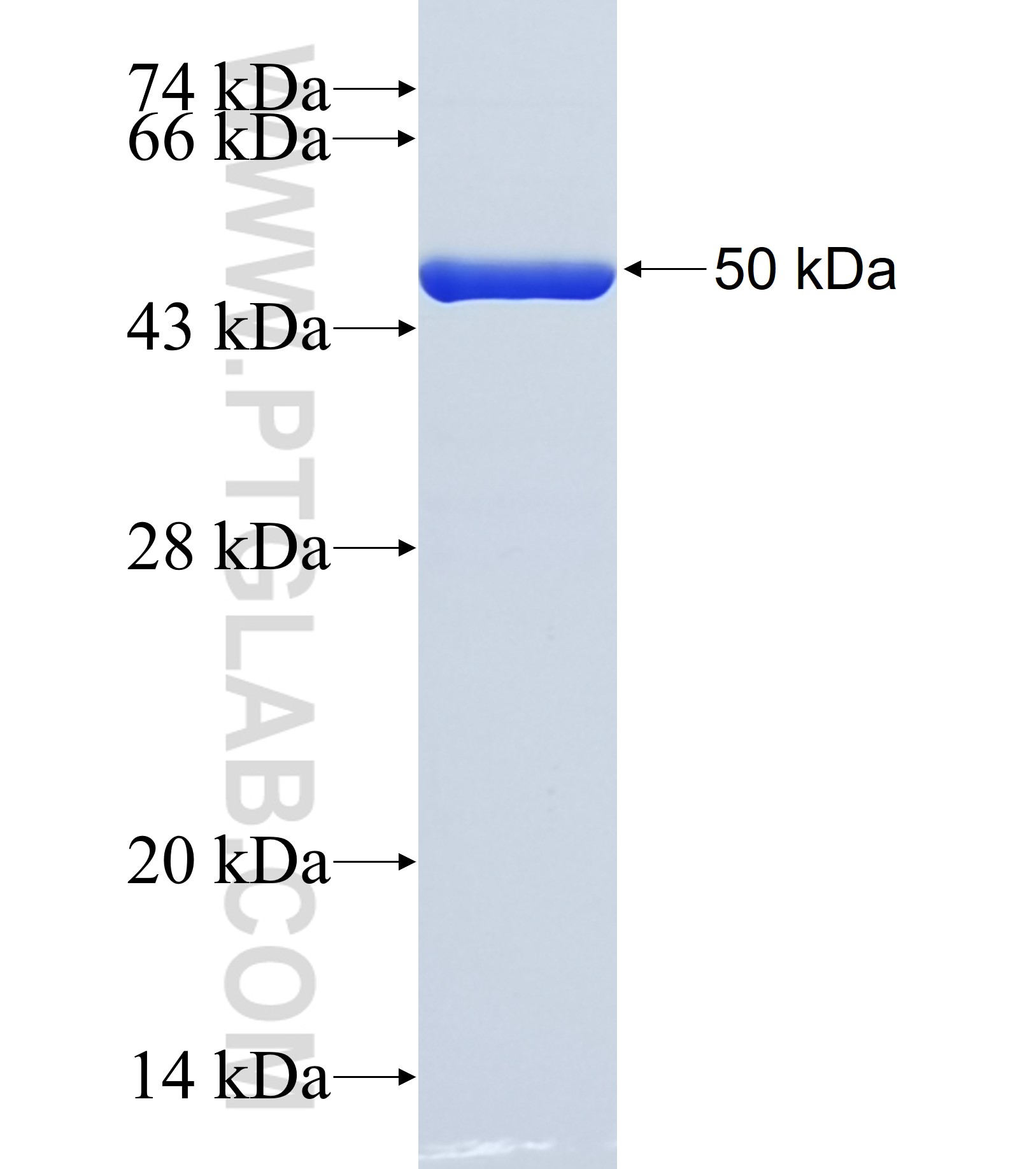 NPR2 fusion protein Ag32763 SDS-PAGE NPR2 fusion protein Ag32763 SDS-PAGE