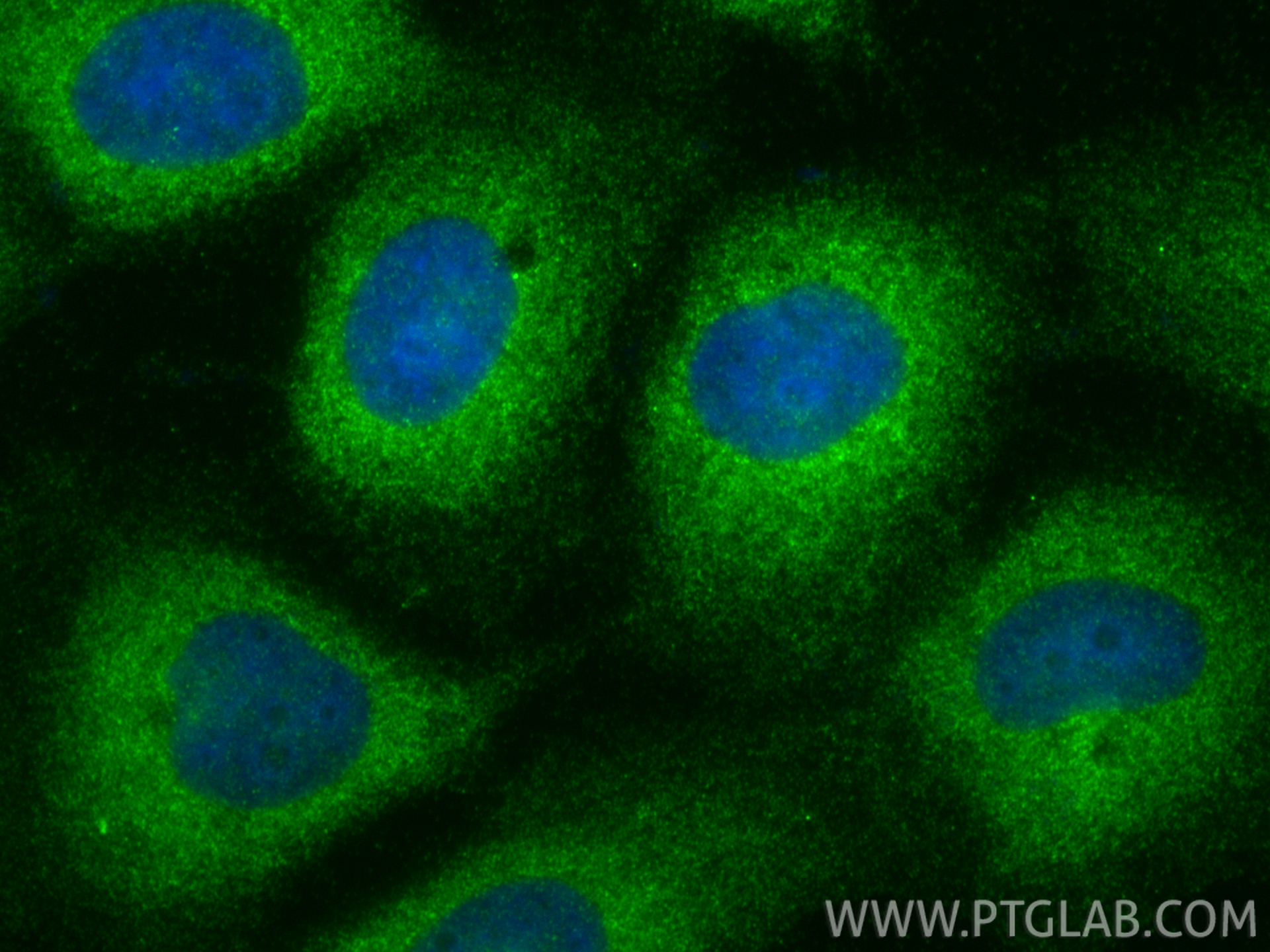 IF Staining of A431 using 26446-1-AP (same clone as 26446-1-PBS)