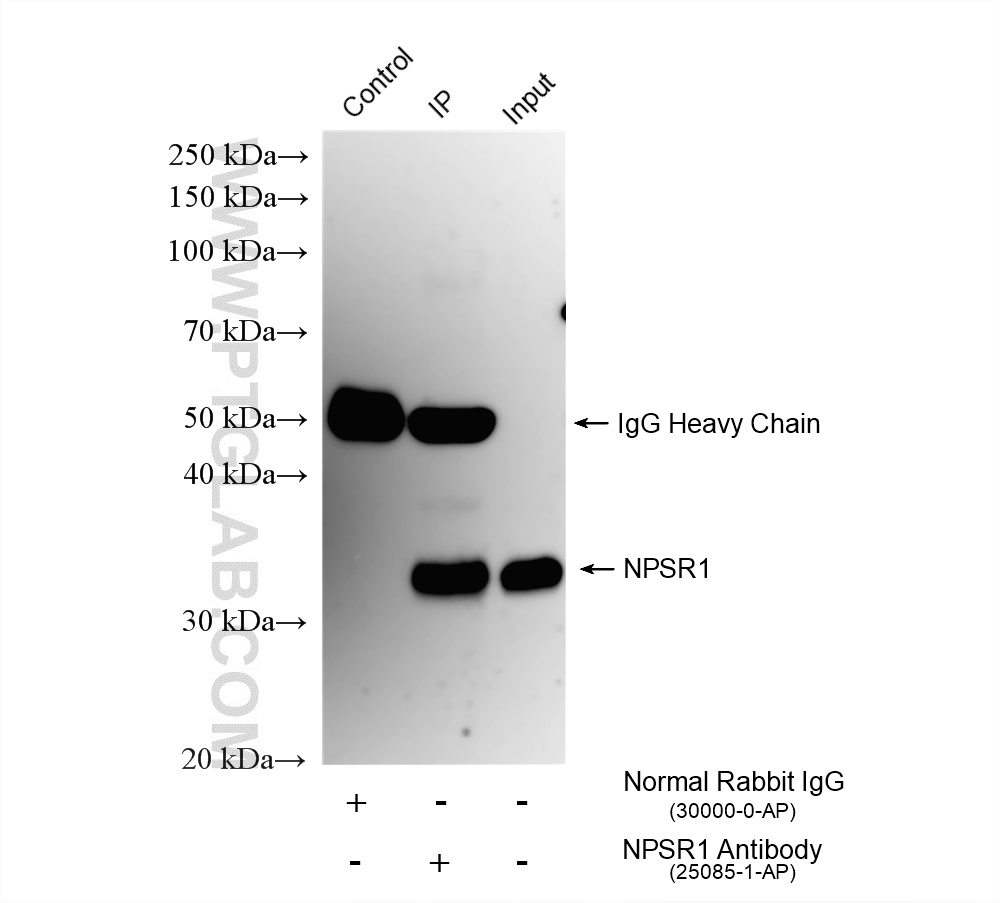 IP experiment of mouse lung using 25085-1-AP IP experiment of mouse lung using 25085-1-AP