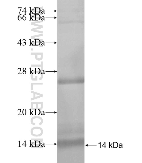 NPSR1 fusion protein Ag18968 SDS-PAGE NPSR1 fusion protein Ag18968 SDS-PAGE