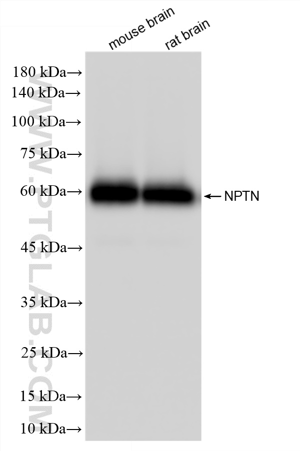 WB analysis using 87125-3-RR (same clone as 87125-3-PBS) WB analysis using 87125-3-RR (same clone as 87125-3-PBS)