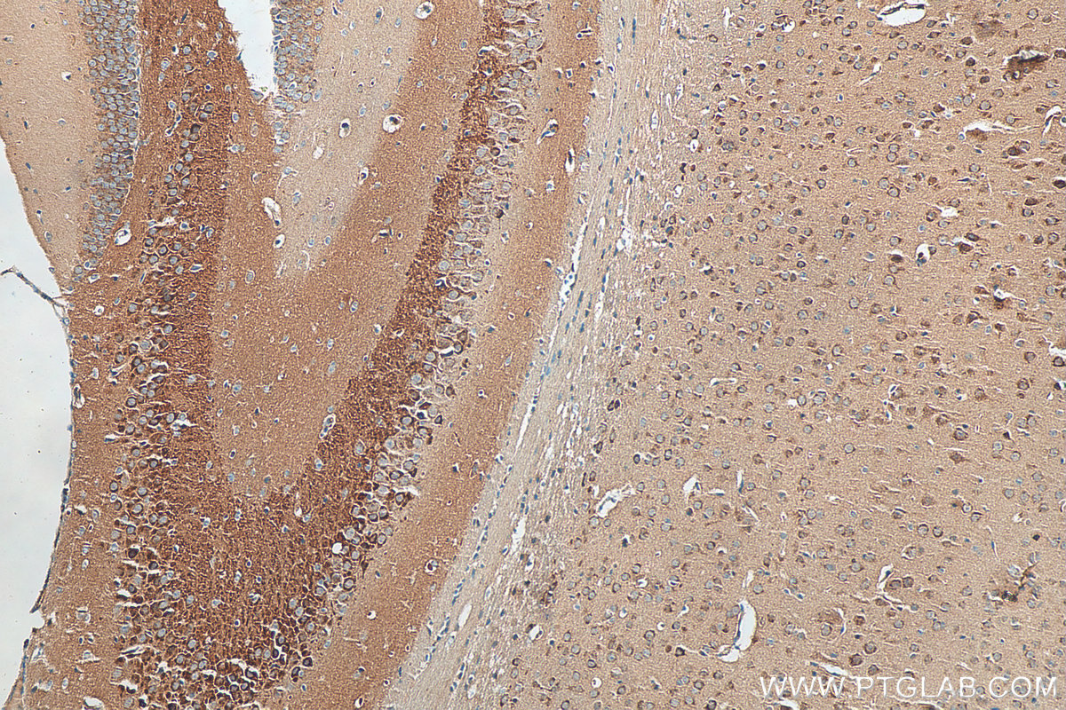 IHC staining of mouse brain using 20656-1-AP