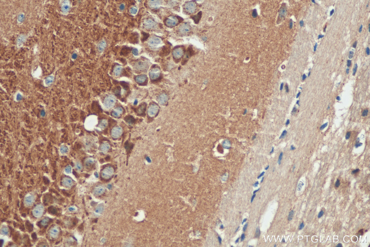 IHC staining of mouse brain using 20656-1-AP