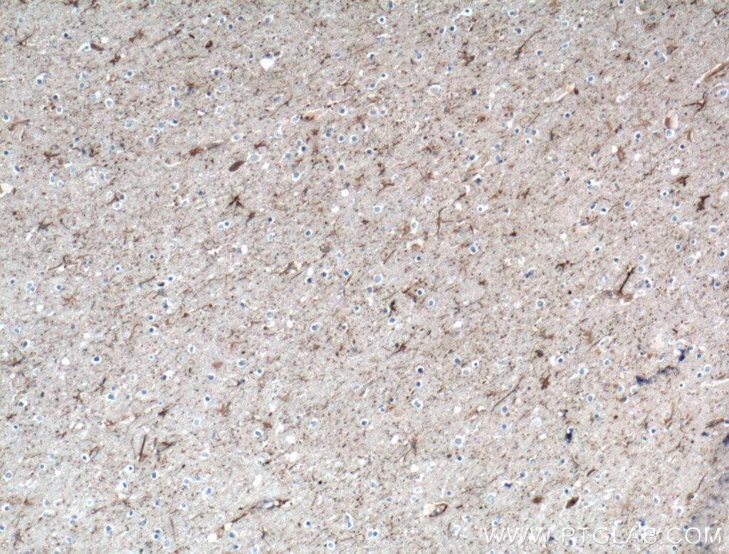 IHC staining of human brain using 10889-1-AP