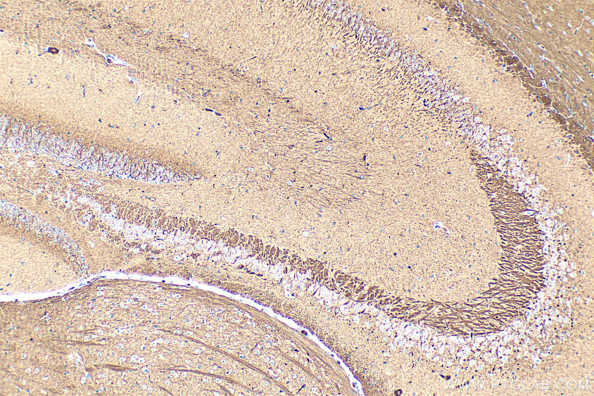 Immunohistochemical analysis of paraffin-embedded mouse brain tissue slide using <a class='green' href='/productredirect?CatalogNo=68709-1-Ig' target='_blank'>68709-1-Ig</a> (NPTX2 antibody) at dilution of 1:1000 (under 10x lens). Heat mediated antigen retrieval with Tris-EDTA buffer (pH 9.0). This data was developed using the same antibody clone with 68709-1-PBS in a different storage buffer formulation. IHC staining of mouse brain using 68709-1-Ig (same clone as 68709-1-PBS)