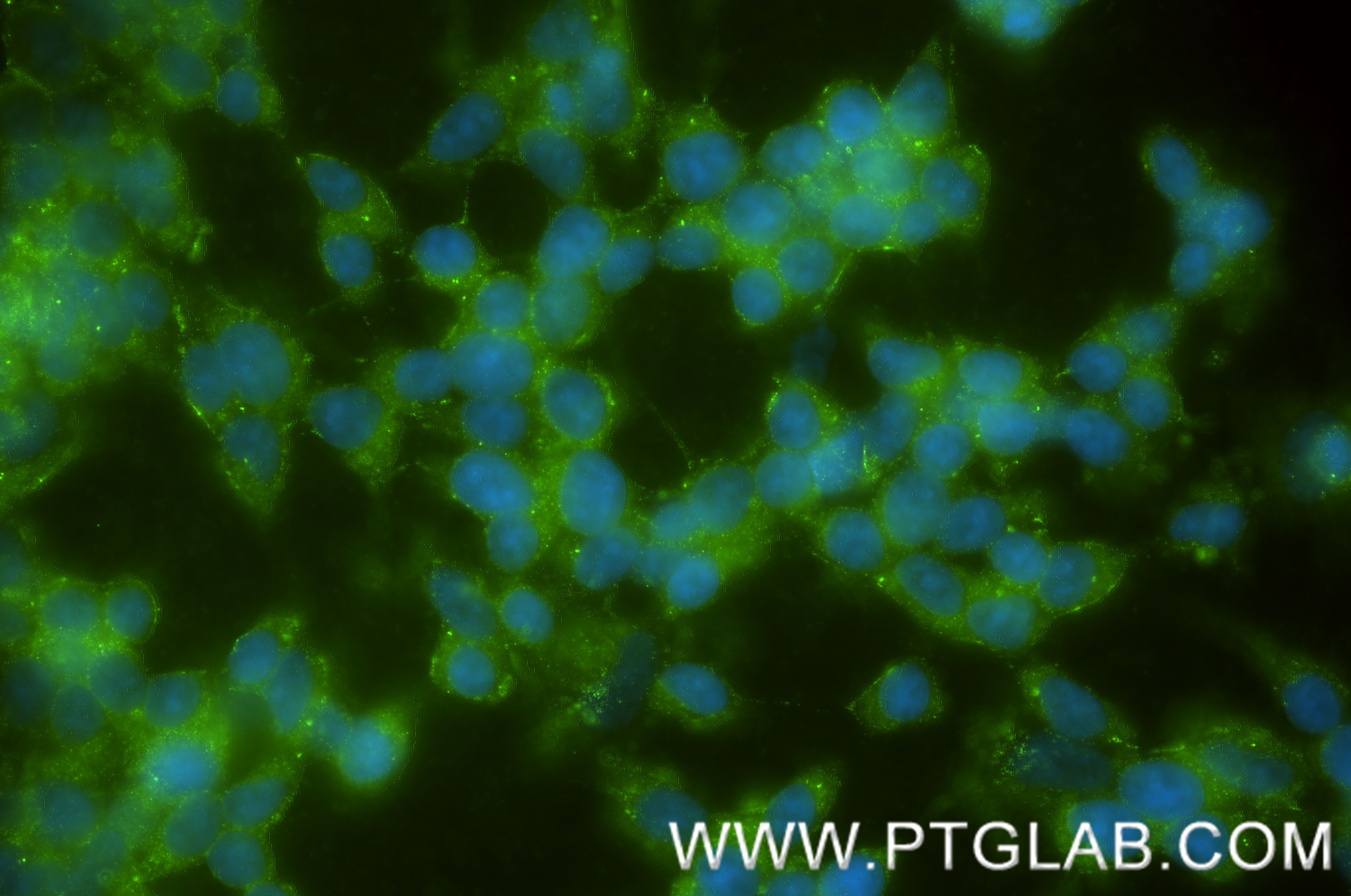 IF Staining of SH-SY5Y using 86203-1-RR (same clone as 86203-1-PBS) IF Staining of SH-SY5Y using 86203-1-RR (same clone as 86203-1-PBS)