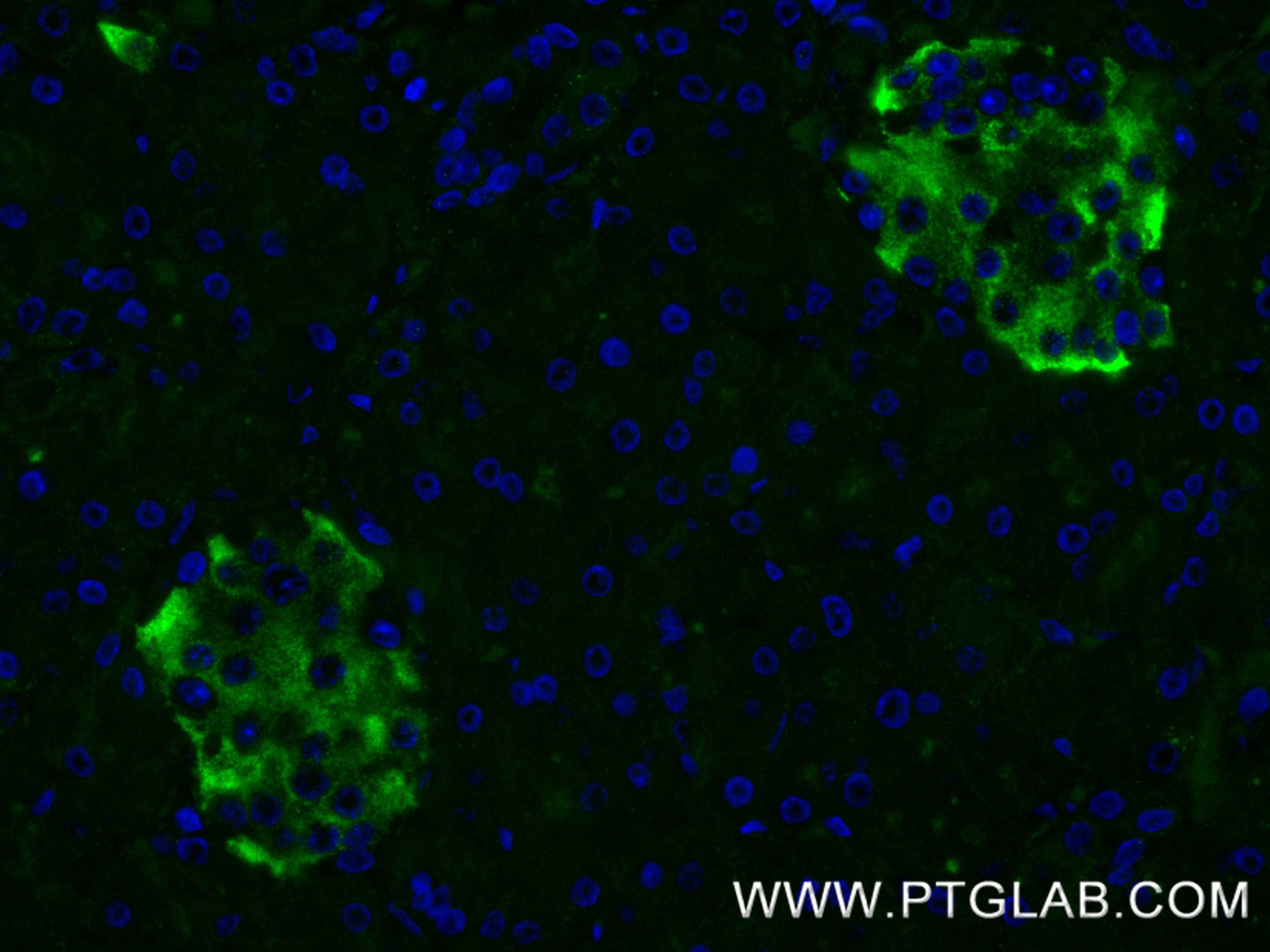 IF Staining of human pancreas using 86203-1-RR