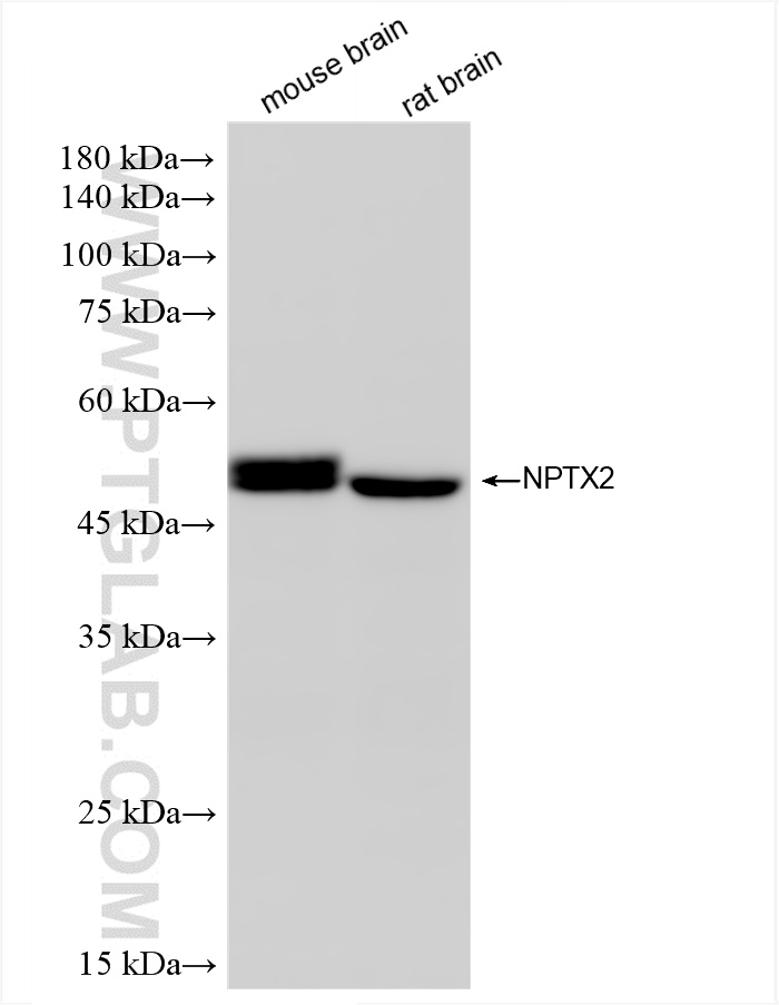WB analysis using 86203-1-RR