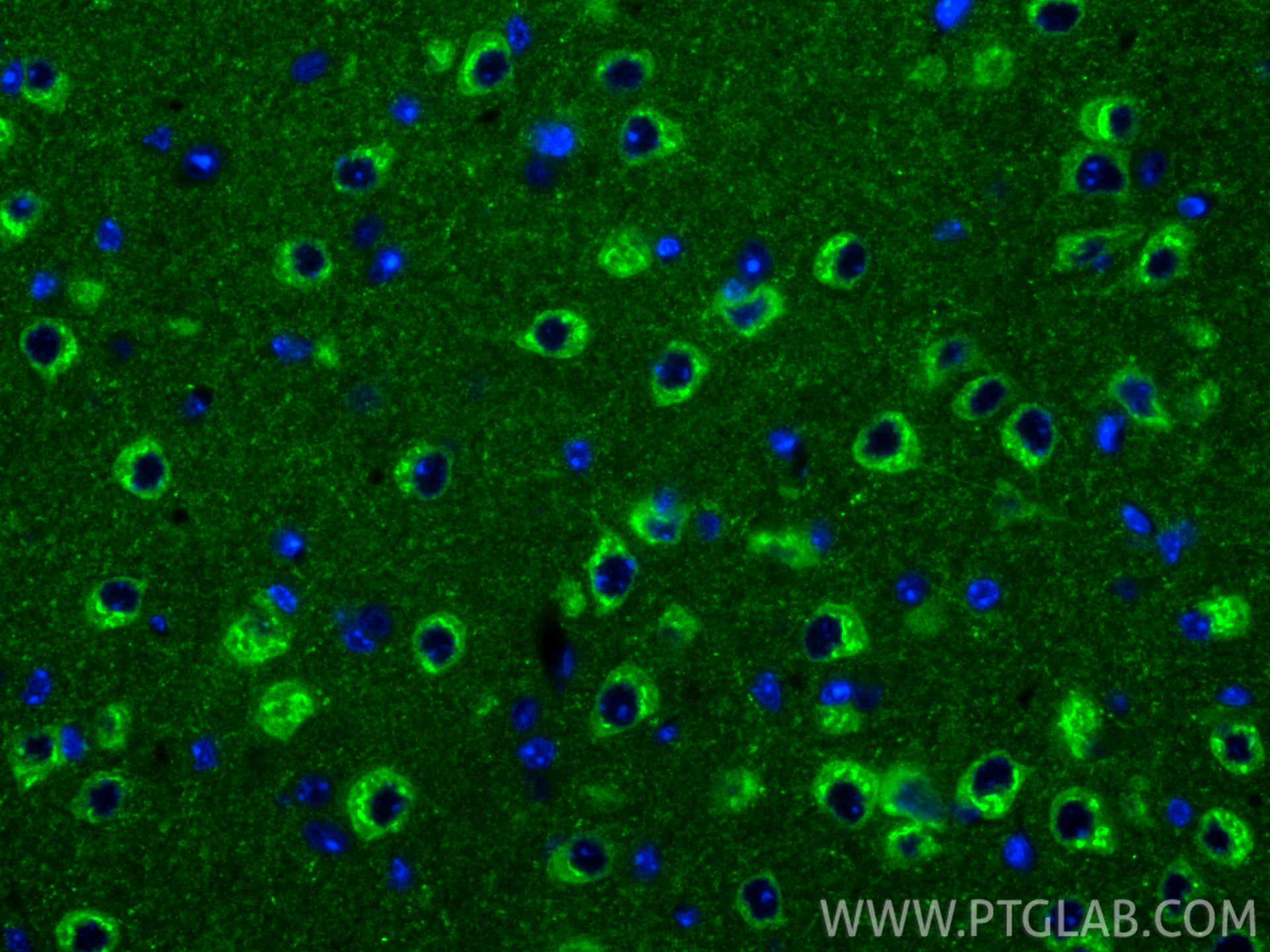 IF Staining of mouse brain using 24807-1-AP