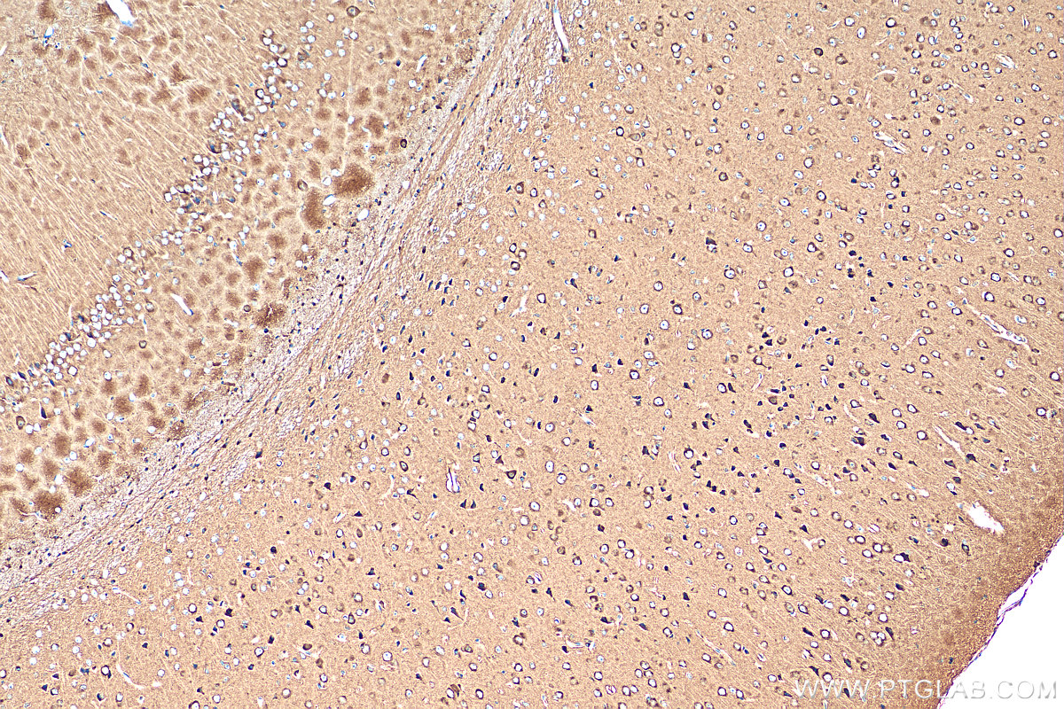 IHC staining of mouse brain using 24807-1-AP (same clone as 24807-1-PBS)